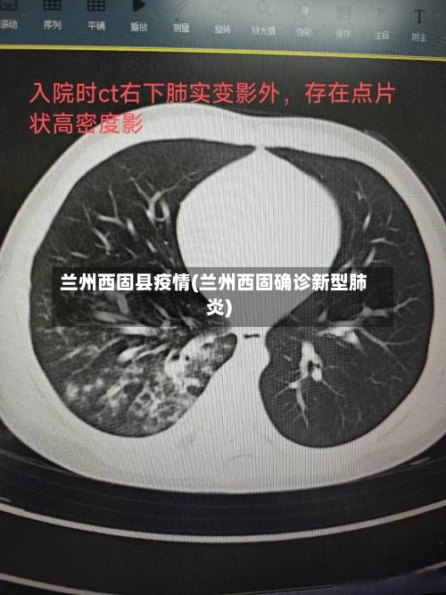 兰州西固县疫情(兰州西固确诊新型肺炎)-第2张图片